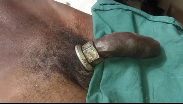 Hospital Accident Catheter Incontinent Cock 60